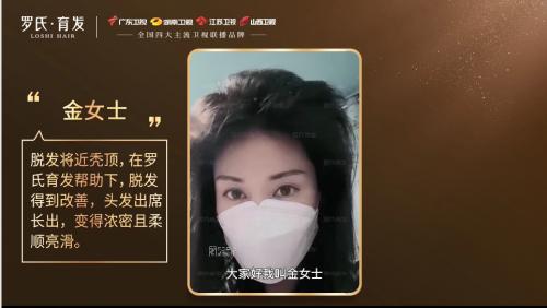 鼓舞發友直面脫發！羅締發域帶領發友擺脫脫發，分享育發歷程